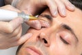 Middle aged man having laser plasma pen therapy on eyelids