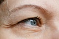 Middle-aged woman does corrective eye makeup to correct the drooping eyelid. Ptosis is a drooping of the upper eyelid, lazy eye. Royalty Free Stock Photo