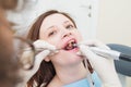 Middle aged woman patient at the dentist polishing the tooth with a disc and making dental fillings