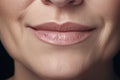 Middle-aged woman\'s nasolabial folds and wrinkles around mouth