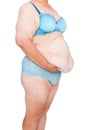 Middle aged woman with sagging skin after babies and extreme weight loss. 45 deg view holding excess belly skin.