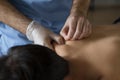 Midsection of Physiotherapist or doctor performing a dry needling treatment