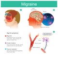 Migraine. Headache, pain, tend cooccur on one side of the headP