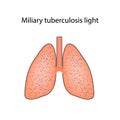 Miliary tuberculosis. Vector illustration on isolated background Royalty Free Stock Photo