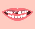Milk Tooth and Permanent Teeth in Eruption Royalty Free Stock Photo