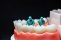 Miniature figurines of surgeons working on a large model of human teeth Royalty Free Stock Photo