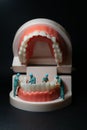 Miniature figurines of surgeons working on a large model of human teeth Royalty Free Stock Photo