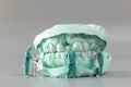 Miniature people ,A dentist displaying dental models and plaster orthodontic models