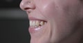 Misaligned Teeth with Prominent Canine Tooth Above the Dental Line