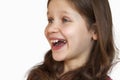 Missing teeth child toothless concept.  Baby tooth - little girl with missing teeth Royalty Free Stock Photo