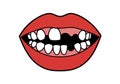 Missing teeth clipart Royalty Free Stock Photo