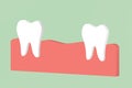 Missing tooth, space between teeth in mouth