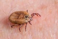 Mite crawls on human skin