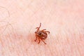Mite on the skin. Danger of tick bite Royalty Free Stock Photo