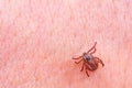 Mite on the skin. Danger of tick bite Royalty Free Stock Photo