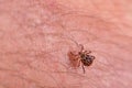 Mite on the skin. Danger of tick bite. Royalty Free Stock Photo