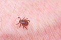 Mite on the skin. Danger of tick bite. Royalty Free Stock Photo