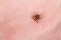 Mite on the skin. Danger of tick bite. Royalty Free Stock Photo