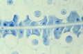 Mitosis Horse Ascaris egg under the microscope