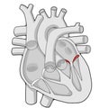 Mitral valve - Heart - Human body - Education Royalty Free Stock Photo