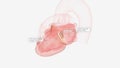 healty Mitral valve The mitral valve is located between the left atrium