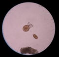 Mix egg parasite human Royalty Free Stock Photo