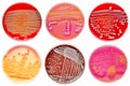 Mixed of bacteria colonies in petri dish