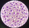 Mixed mature white blood cells on red blood cells background