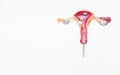 Mock female reproductive system on a white background. The concept of sexually transmitted infections, bacterial