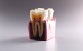 Mock tooth in section, educational model of tooth, anatomy of human oral tooth