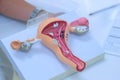 Model of female reproductive system. Doctor explains patient structure of organ.