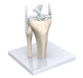 Model Of A Healthy Knee Joint. Bones, Cartilage, Ligaments And Meniscus. 3D Illustration