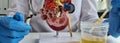 Model of human kidney and ureter on table of urologist doctor with urinalysis test closeup