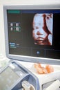 Model of image of mature fetus is on ultrasonographer monitor screen, face of baby Royalty Free Stock Photo