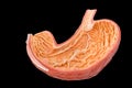 Model inside of human stomach on black background