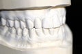 Human teeth made of plaster Royalty Free Stock Photo