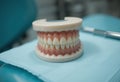 A model of a set of teeth is on a blue table Royalty Free Stock Photo