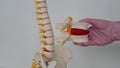 Model of the Spinal Cord and Vertebrae Lumbar Vertebra with Protrusion.