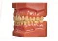 Model teeth and gums on white