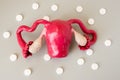 Model of uterus with appendages - fallopian tubes and ovaries is surrounded by white pills or drugs on gray background closeup. Ph