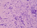 Moderate bacteria cells with Gram stain method.