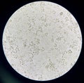 Moderate bacteria and white blood cells in urine