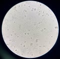 Moderate bacteria and white blood cells in urine