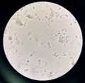 Moderate bacteria and white blood cells in urine