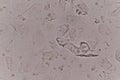 Moderate epithelial cells in urine specimen