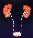 Modern ct urogram colorful structure kidneyes