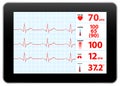 Modern Electrocardiogram Monitor Device Display