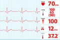 Modern Electrocardiogram Monitor Display