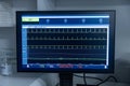 Modern equipment with vital signs monitors in operating room of contemporary clinic. Cardiogram signal monitoring process. The