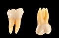 Molar teeth isolated on black Royalty Free Stock Photo